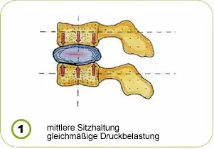 Richtige Sitzhaltung – Bandscheibenbelastung